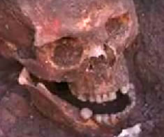 Crâne de Richard III
